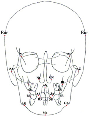 Zygomatic Frontal Suture