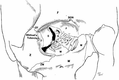 Zygomatic Frontal Suture